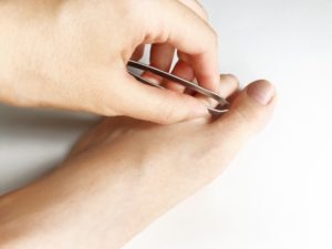 指先も綺麗に!指毛ケア後に現れる毛穴の黒い点の簡単対処法